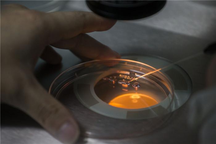 ▲医生在显微镜下对将要进行冷冻的受精卵胚胎进行处理液浸泡的预处理。