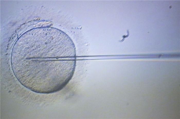 ▲医生在电子显微镜下对卵子进行第二代人工受精。