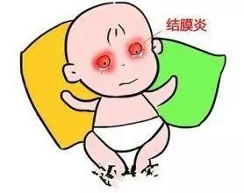 宝宝眼红是患了"红眼病"?还可能患上了这种常见眼科疾病