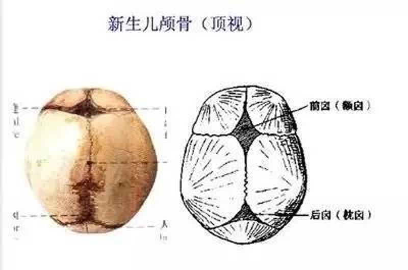 婴儿出生时,这些骨骼还没有发育好,骨缝没有完全闭