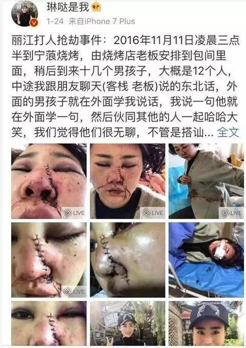 丽江被打女游客二次伤情鉴定, 面部三处构成轻伤二级