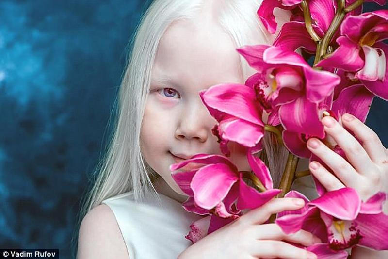 8岁白化病女孩被封"西伯利亚白雪公主"