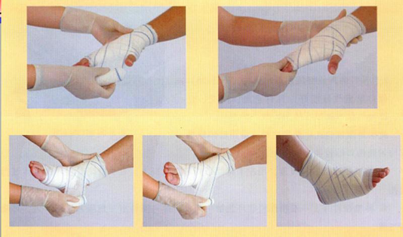 环形包扎法通常适用于伤口比较小的情况,伤口比较大要在环形包扎法的