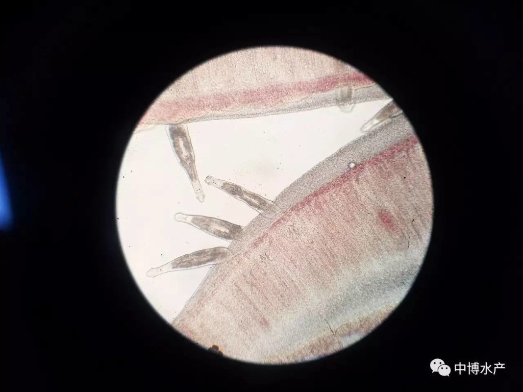 震撼图集!一线技术员显微镜下拍摄14种寄生虫是如何入侵鱼虾的