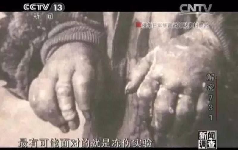 日本"731部队"用中国人进行秘密人体实验,研发细菌武