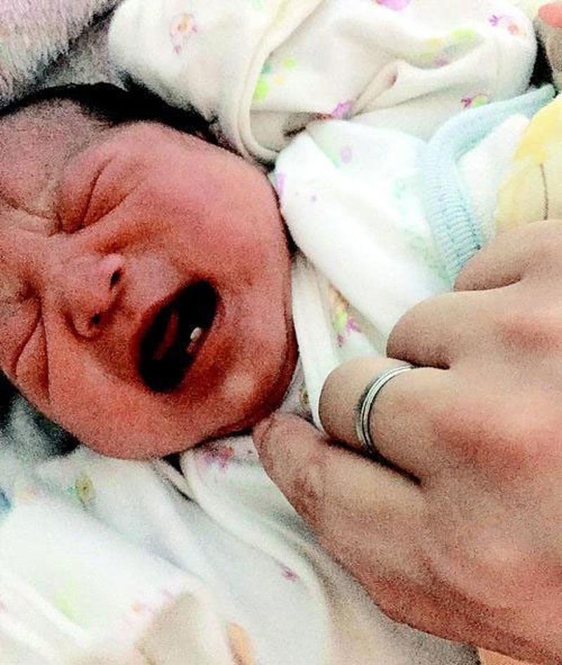 惠州一宝宝刚出生就有两颗小牙是补钙过多导致的