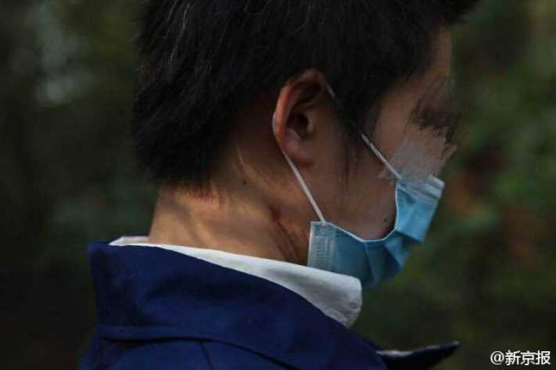 10月13日上午,在北京八达岭野生动物园老虎伤人事件中受伤烦人女游客