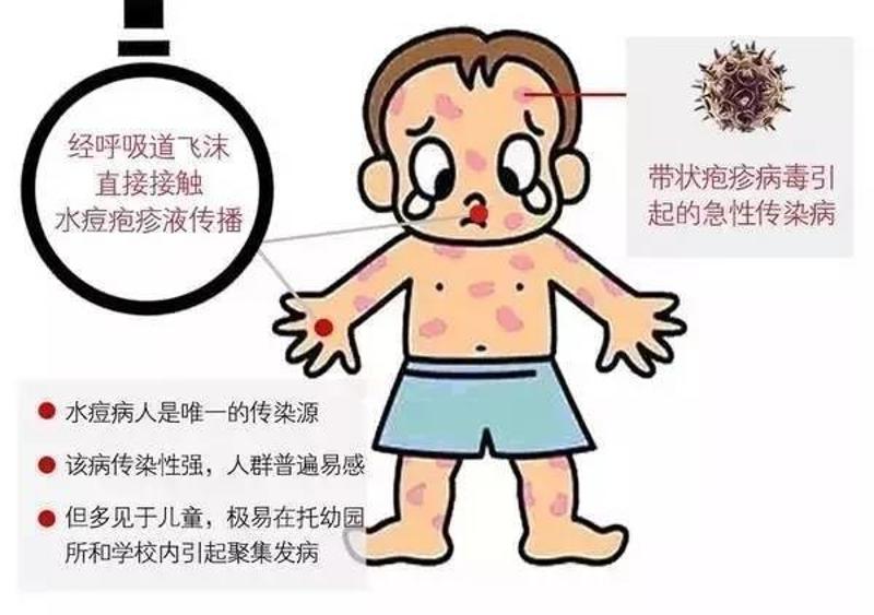 小儿水痘判断图片