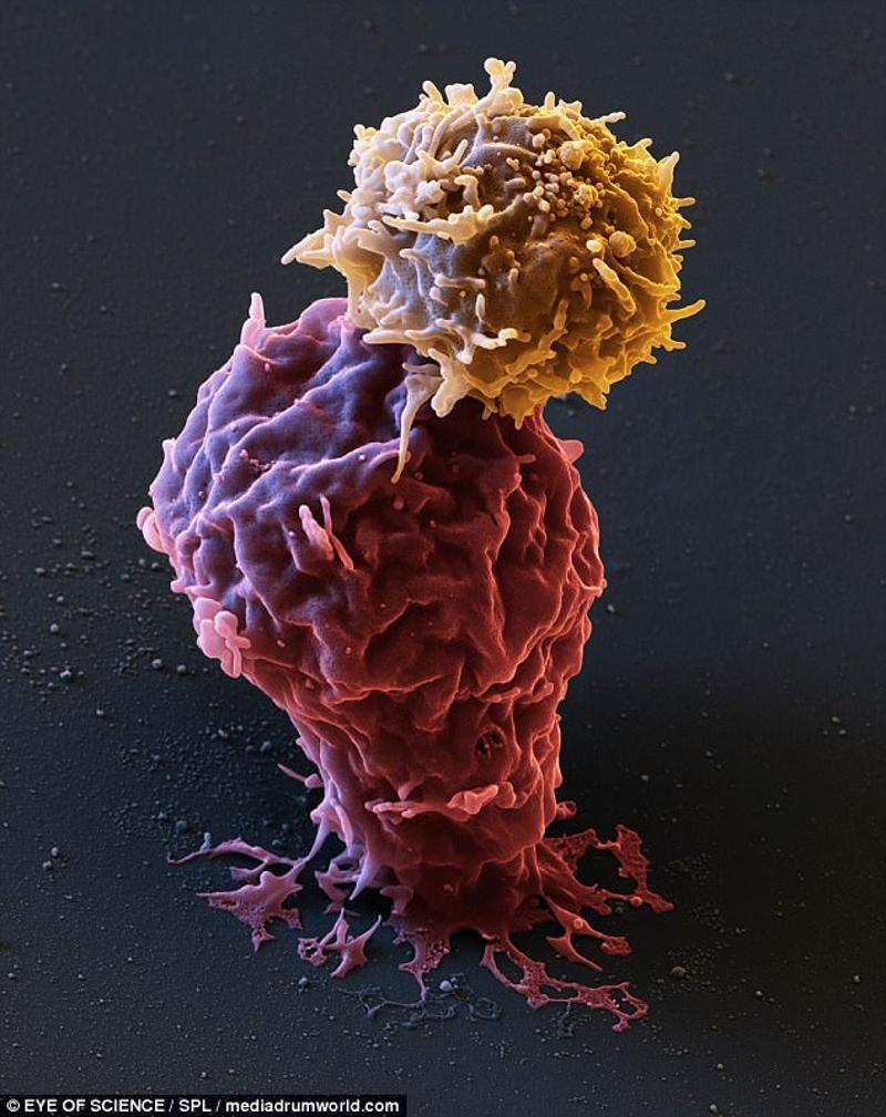 癌细胞长啥样?细胞之间如何搏斗?德国摄影师拍出来了