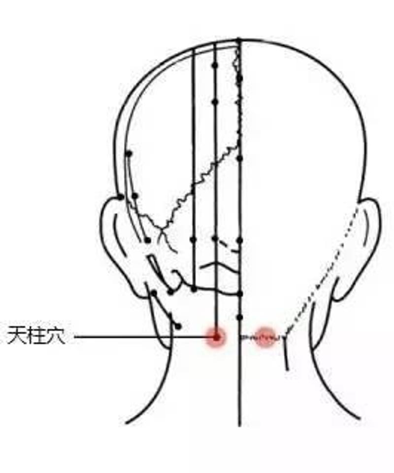 头痛,牙痛,落枕,腰痛……,指压立竿见影