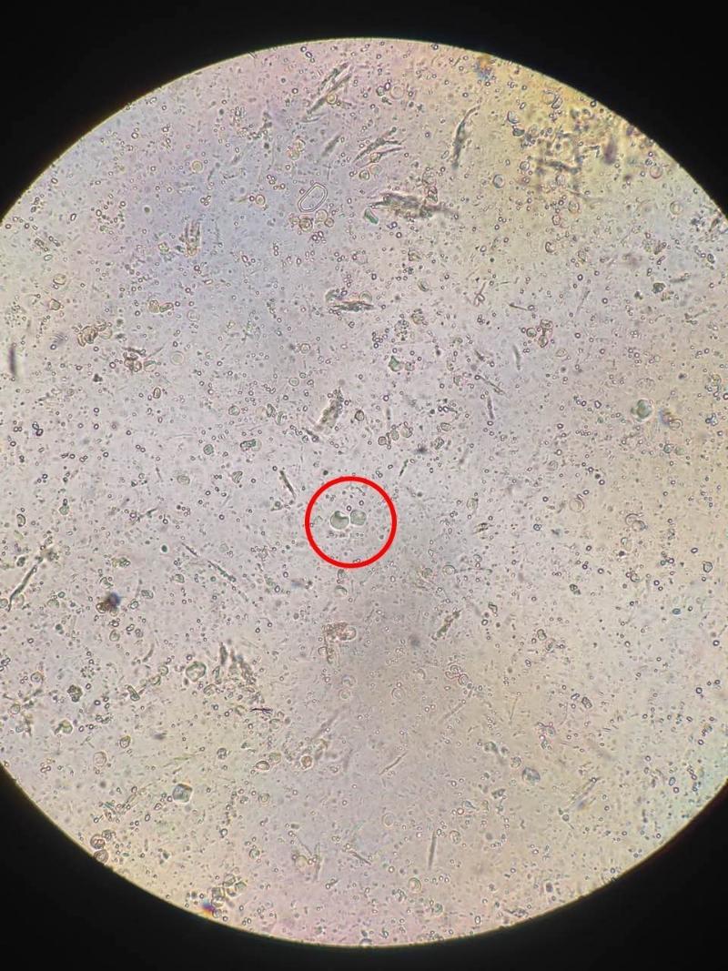 人芽囊原虫染色图片