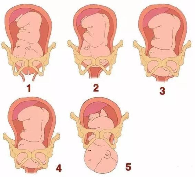 胎儿顺产步骤图片图片