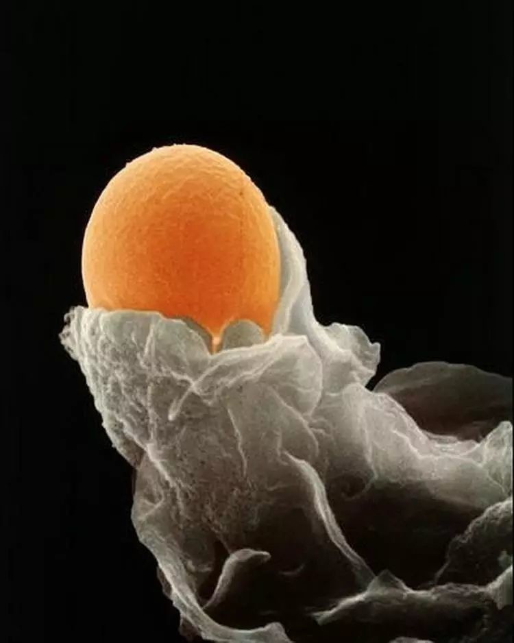 卵子的样子的图片图片