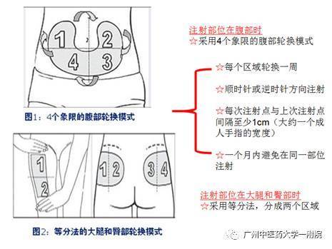 说说胰岛素的那些事