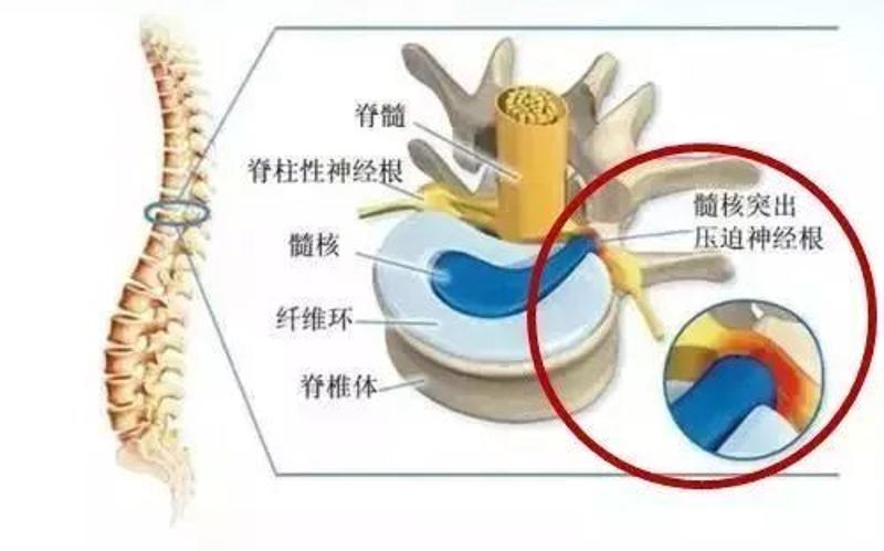 中老人年人腿抽筋,别盲目补钙!这些才是真正原因