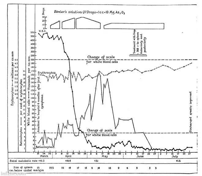 ▲尽管很多中国学者自称是砷剂治疗白血病的发明人，但1930年代，美国就已出现使用口服、注射、静脉及缓释砷剂给药法治疗白血病。图为1931年，福克纳医生在国际期刊JAMA上发表的砷剂治疗CML型白血病患者的疗效图。（李永明供图/图）